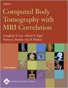 Computed Body Tomography with MRI Correlation (2 Volume